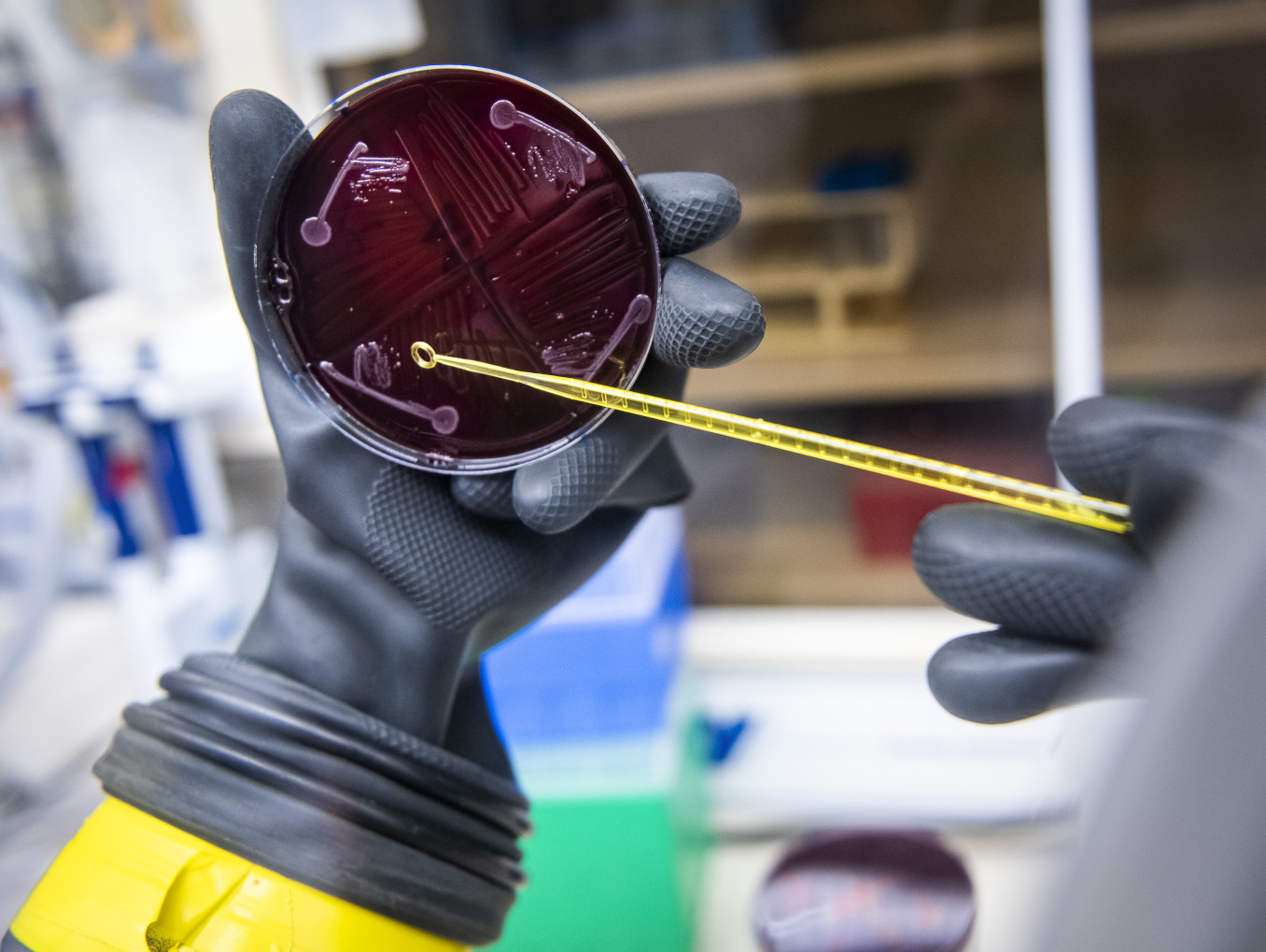 A bacterial isolate from the human microbiome growing on a petri dish in the laboratory.